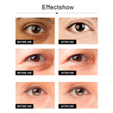 Snake Venom Eye Cream, Firming Eye Bags Hydrating And Reducing Fine Lines Eye Care Eye Cream - V.I.P Digital Presence