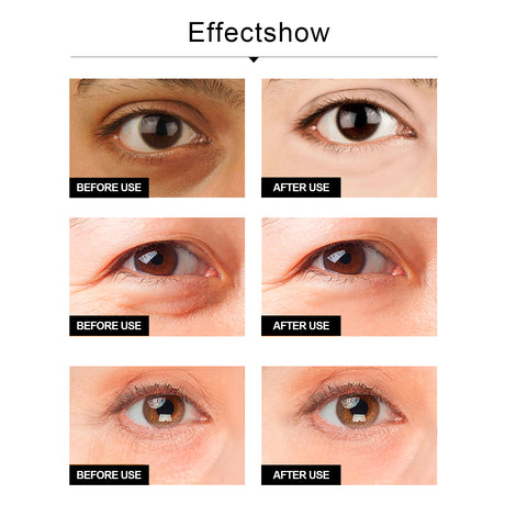 Snake Venom Eye Cream, Firming Eye Bags Hydrating And Reducing Fine Lines Eye Care Eye Cream - V.I.P Digital Presence
