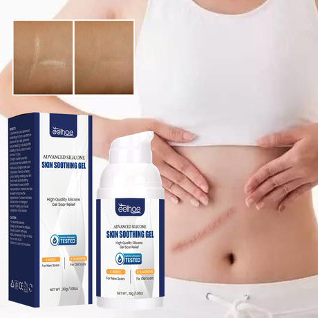 Scar Gel, Fade Skin Scar Pregnancy Surgery Scar Moisturizing Skin Care Gel - V.I.P Digital Presence