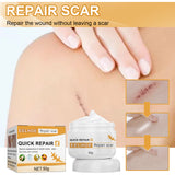 Desalting Skin Scar Cream, Skin Burn Scalding Surgical Scar Wound Repair Cream - V.I.P Digital Presence