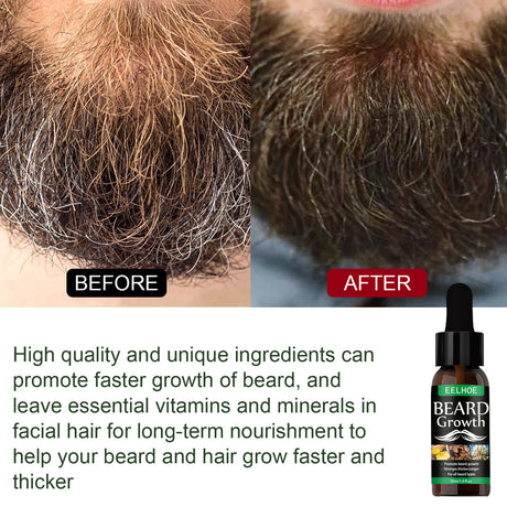 Beard Oil, Nourishing Moisturizing Spray Facial Hair Treatment Promotes Facial Growth And Thickening Liquid - V.I.P Digital Presence