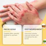 Skin Care Cream Moisturizing Herbal Cool Soothing Moisturizing Anti-Dandruff Moisturizing Gentle Skin Care
