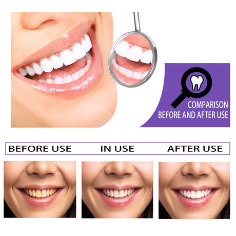 Teeth Whitening Toothpaste, Removing Teeth Stains And Odors Oral Care Brightening And Whitening Teeth Toothpaste - V.I.P Digital Presence