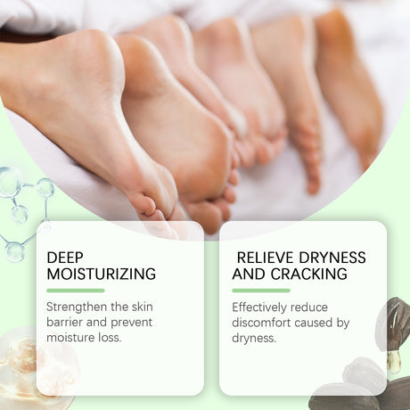 Hand And Foot Urea Cream Hydrates And Moisturizes Foot Skin To Prevent Cracking And Drying Foot Cream - V.I.P Digital Presence