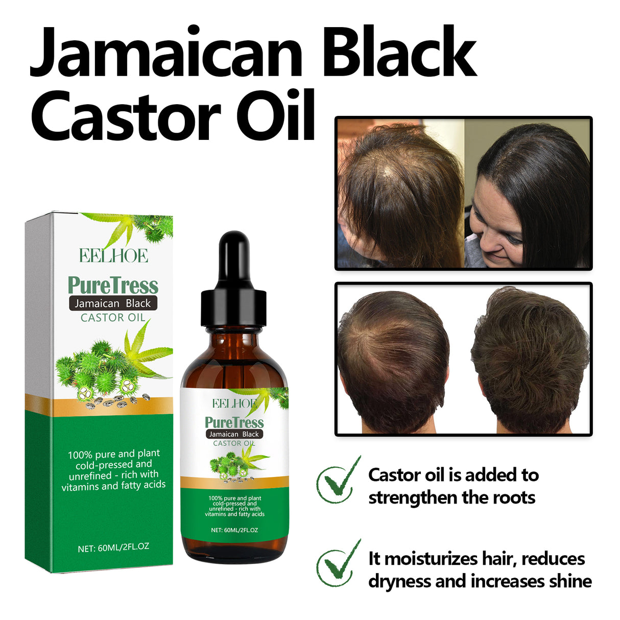 Jamaican Black Castor Oil, Moisturize Scalp And Prevent Dry Hair Thick And Solid Hair Beautiful And Shiny Easy To Absorb Essential Oils - V.I.P Digital Presence