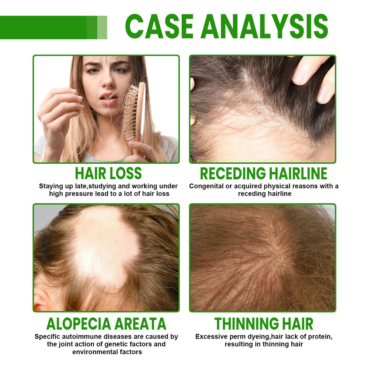 Hair Root Spray, Repair Dry Hair Fickle Hair Tight Hair To Prevent Smooth Hair - V.I.P Digital Presence