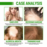 Hair Root Spray, Repair Dry Hair Fickle Hair Tight Hair To Prevent Smooth Hair - V.I.P Digital Presence