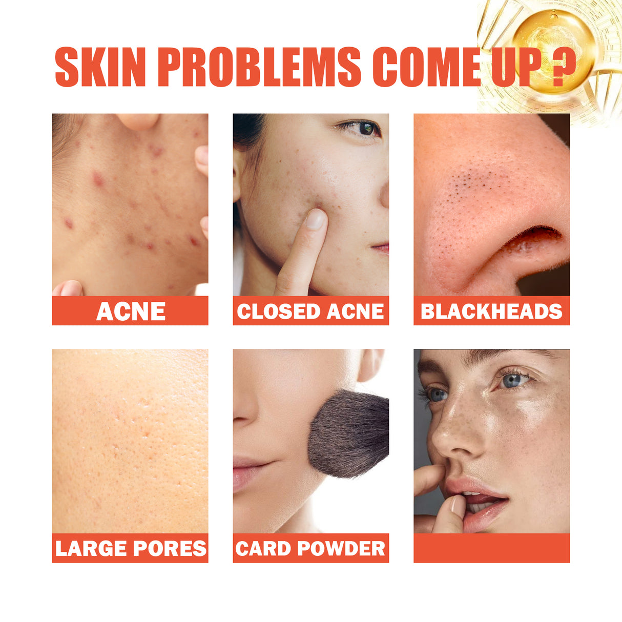 Snail Nourishing Repair Essence, Lightening Acne Muscle Acne Mark, Hydrating Whitening And Eliminate Pimples Essence - V.I.P Digital Presence