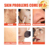 Snail Nourishing Repair Essence, Lightening Acne Muscle Acne Mark, Hydrating Whitening And Eliminate Pimples Essence - V.I.P Digital Presence