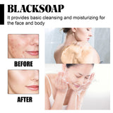 Shea Butter Black Soap, Repair Acne Pimple Acne Clear Pores Moisturize Smooth Skin Soap