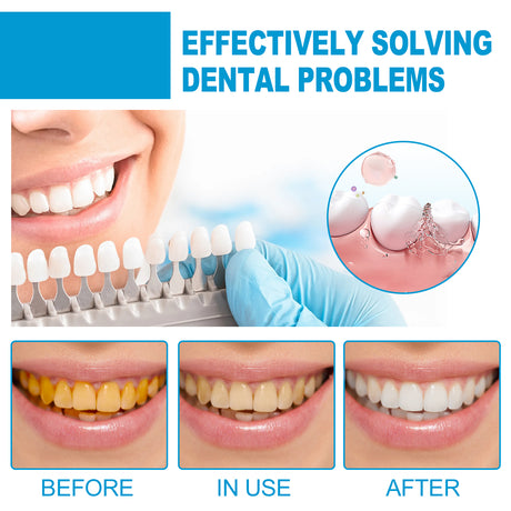 Mouth Mousse Toothpaste Teeth Clean Teeth Remove Tartar Stains Yellow Teeth Whitening Teeth Fresh Breath - V.I.P Digital Presence