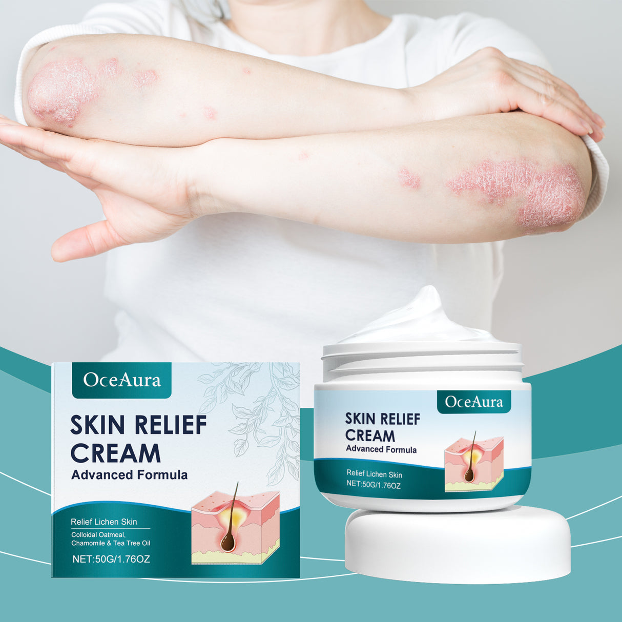 Crema para el cuidado del folículo piloso Cuidado del cuero cabelludo Espalda Rostro Limpieza Reparación Acné Crema para el cuidado del folículo piloso