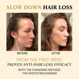 Hair Boost Darken Strengthen Essence, Scalp Massage Moisturizing Hair Roots Thick Smooth Hair Care Ball - V.I.P Digital Presence