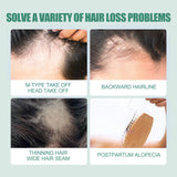 7 Days Essence Gently Moisturizes Hydrating Hairline Scalp Root Nourishing Hair Care Essential Oil - V.I.P Digital Presence