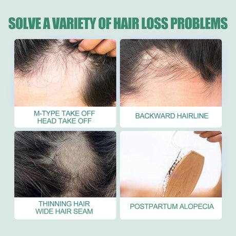 7 Days Essence Gently Moisturizes Hydrating Hairline Scalp Root Nourishing Hair Care Essential Oil - V.I.P Digital Presence