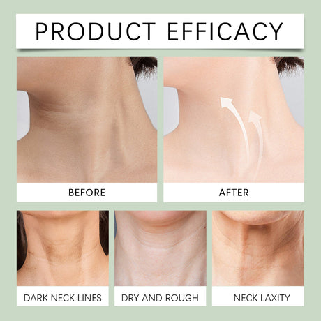 Lines Gone Neck Gel, Neck Moisturizer Improves Neck Lines And Moisturizes Skin Hydrating Gel - V.I.P Digital Presence