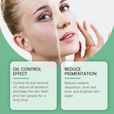 Crema hidratante reparadora con ácido azelaico, control de grasa facial, suave y refrescante.