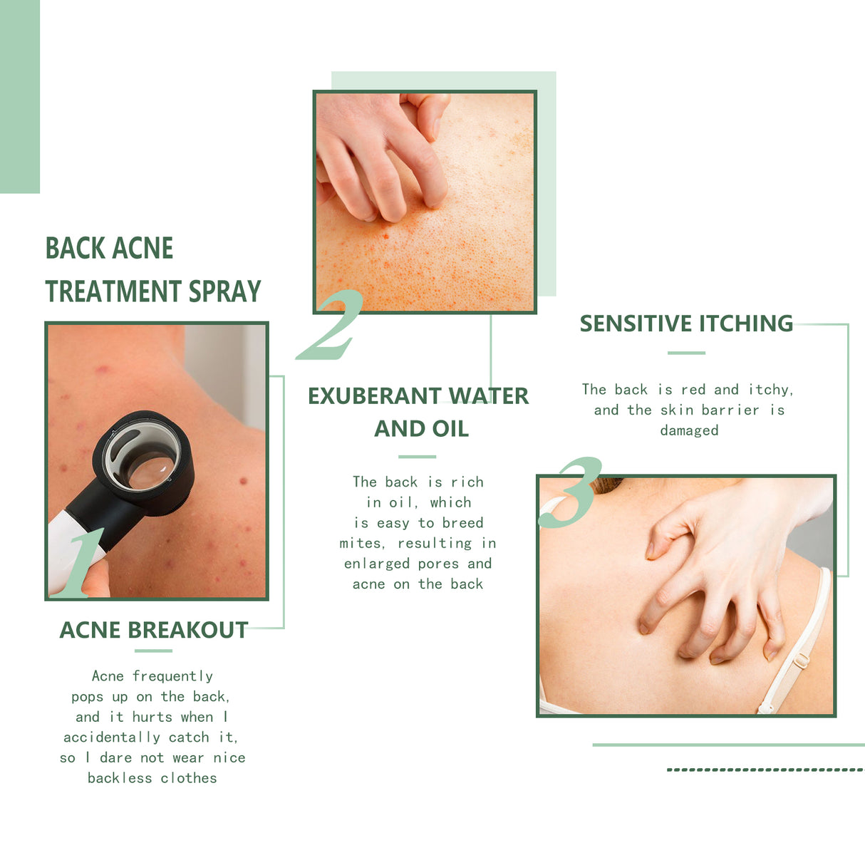 Body Acne Removal Cleanser Spray, Deep Clean Back Arm Fade Acne Beauty Moisturizing Spray - V.I.P Digital Presence