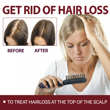 Hair Intensive Essence, Moisturizes Hair Roots, Fast Growing Prevents Loss And Strengthens Hair Care Essence - V.I.P Digital Presence