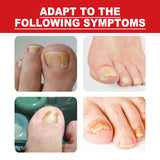 Toenail Repair Essence Moisturizes, Restores And Cleanses Foot Nails And Brightens With Essential Oil