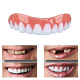 Perfect Smile Veneers Dub In Stock For Correction of Teeth For Bad Teeth Give You Perfect Smile Veneers mouth support - V.I.P Digital Presence