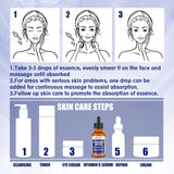 Anti-aging Vitamin C Facial Essence, Reduces Spots Acne Fine Lines, Moisturizes Facial Essence - V.I.P Digital Presence