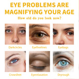 Vitamin E Eye Cream, Lightened Dark Circles Crow's Feet, Firmed And Moisturized Eye Cream - V.I.P Digital Presence