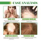 Hair Care Oil, Repair Damage Improve Dry Hair Prevent Hair Loss And Smooth Essential Oil - V.I.P Digital Presence