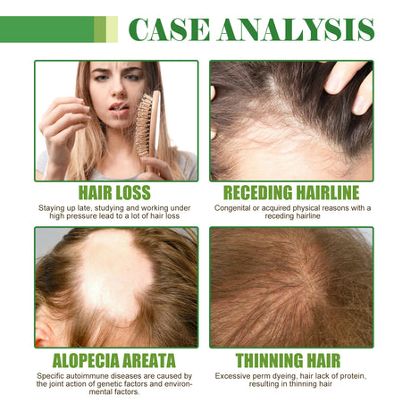 Hair Care Oil, Repair Damage Improve Dry Hair Prevent Hair Loss And Smooth Essential Oil - V.I.P Digital Presence