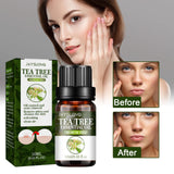 Aceite esencial de árbol de té, reparador del acné, reduce los poros, hidratante, cuidado facial.