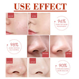 Pore Minimizer Serum, Pore Minimizer Moisture To Deep Clean Pores Carry Bright Moisturizing Essence Serum
