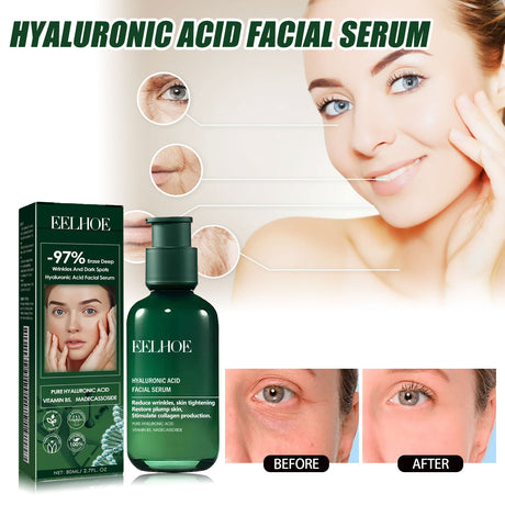 Facial Essence, Lifts And Tightens Facial Skin And Reduces Fine Lines And Wrinkles - V.I.P Digital Presence