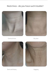 Neck Beautifying Instrument Fishtail Neck Massage To Remove Fine Lines With Color Light Micro Current Can Heat Swan Neck Electric Massage - V.I.P Digital Presence