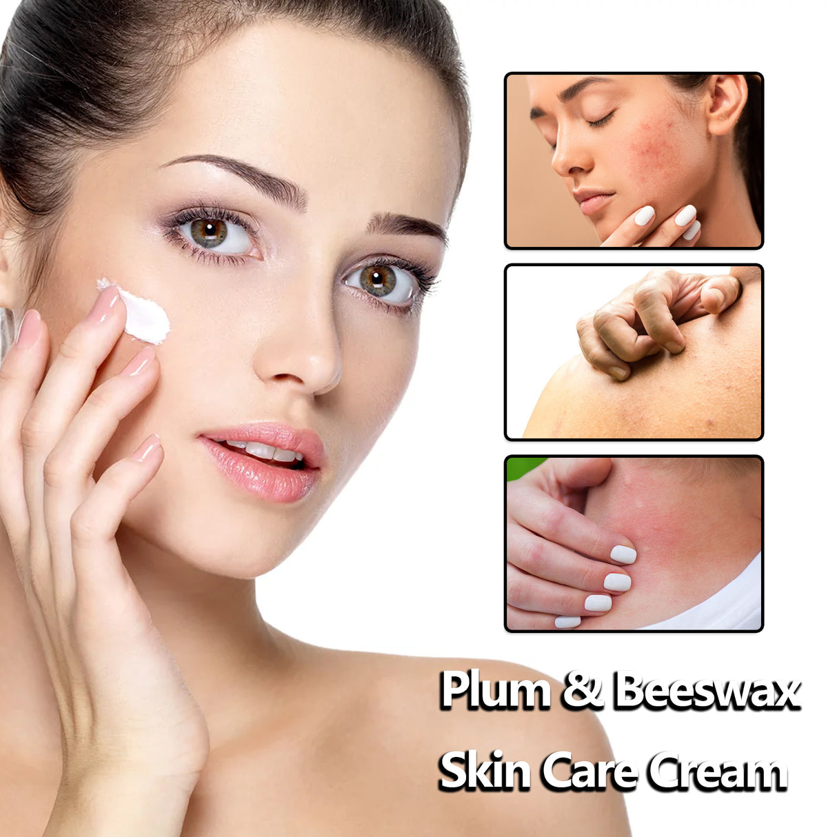 Beeswax Skin Cream Moisturizes Skin, Relieves Dry Skin, Sunburn, Mosquito Bites And Itch Relief Cream - V.I.P Digital Presence