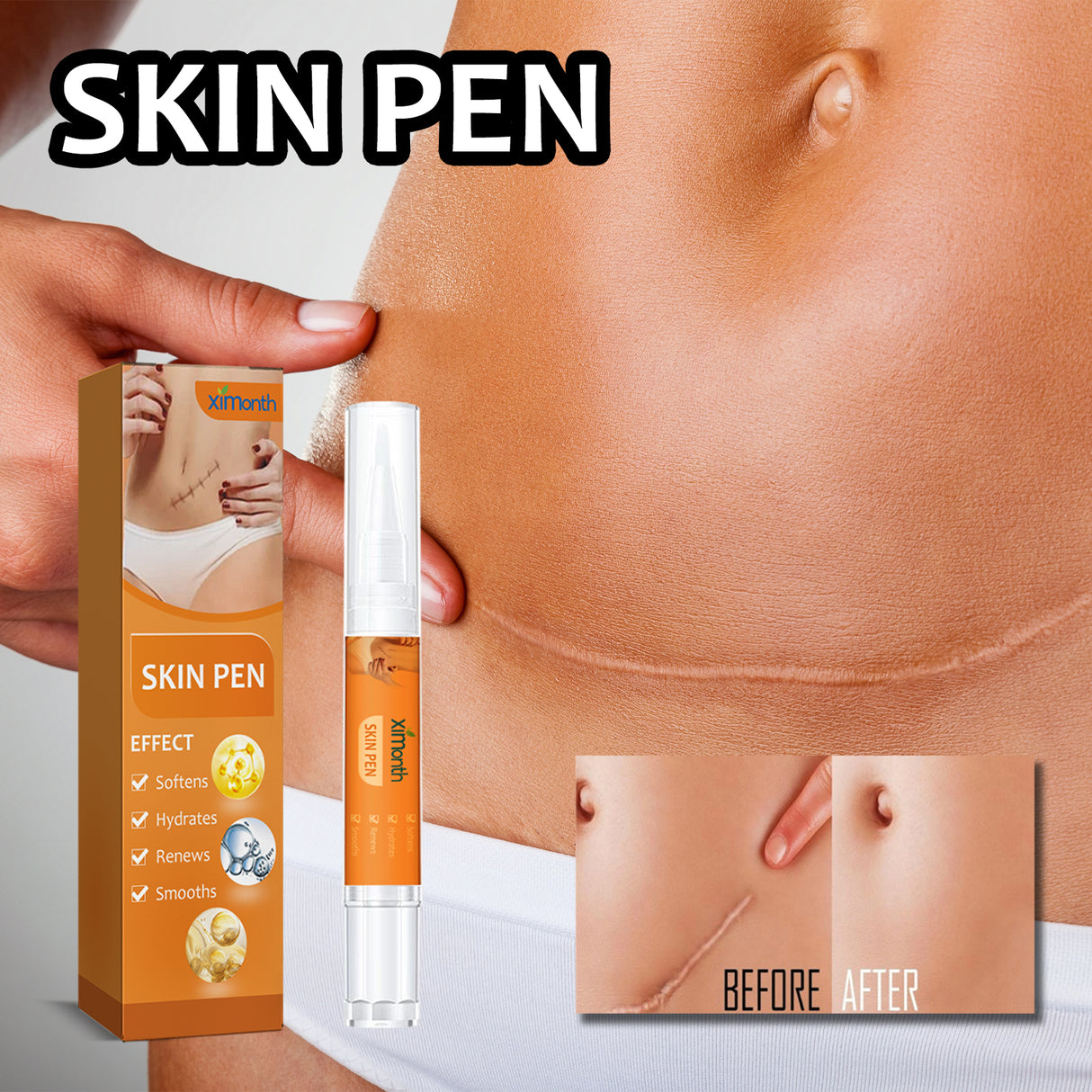 Skin Repair Pen For Reducing Pregnancy Burns Scars And Smoothing The Skin - V.I.P Digital Presence