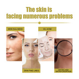 Anti-Aging Essence Hydrates, Moisturizes And Reduces Fine Lines And Wrinkles - V.I.P Digital Presence