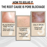 Lactose Solution, Exfoliate Remove Blackheads Shrink Pores Clean And Moisturize SkinEssence