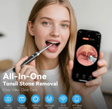 TonsilClear WiFi Stone Remover Kit