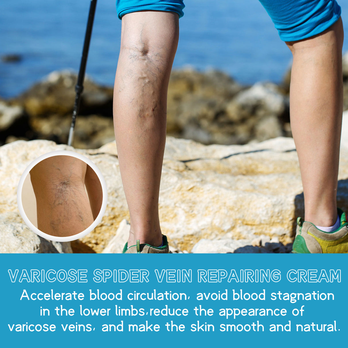 Varicose Spider Vein Repairing Cream, Relief Leg Pain Earthworm Leg Veins Care Massage Cream - V.I.P Digital Presence