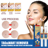 Skin Kayo Pen Gentle Body Tag Remover Cleansing Skin Care Pen