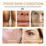 Turmeric Correction Essence Facial Care Hydrating Moisturizing Gentle Moisturizing Skin Care Essence - V.I.P Digital Presence