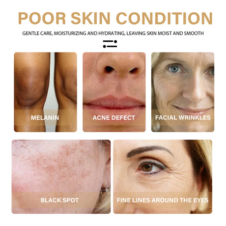 Turmeric Correction Essence Facial Care Hydrating Moisturizing Gentle Moisturizing Skin Care Essence - V.I.P Digital Presence