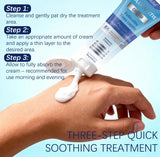 Follicalm Soothing Skin Cream