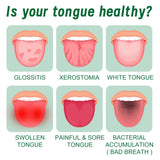 Tongue Repair Spray Repair Tongue Whitening To Relieve Dry, Cracked And Swollen Tongue Oral Care Spray - V.I.P Digital Presence