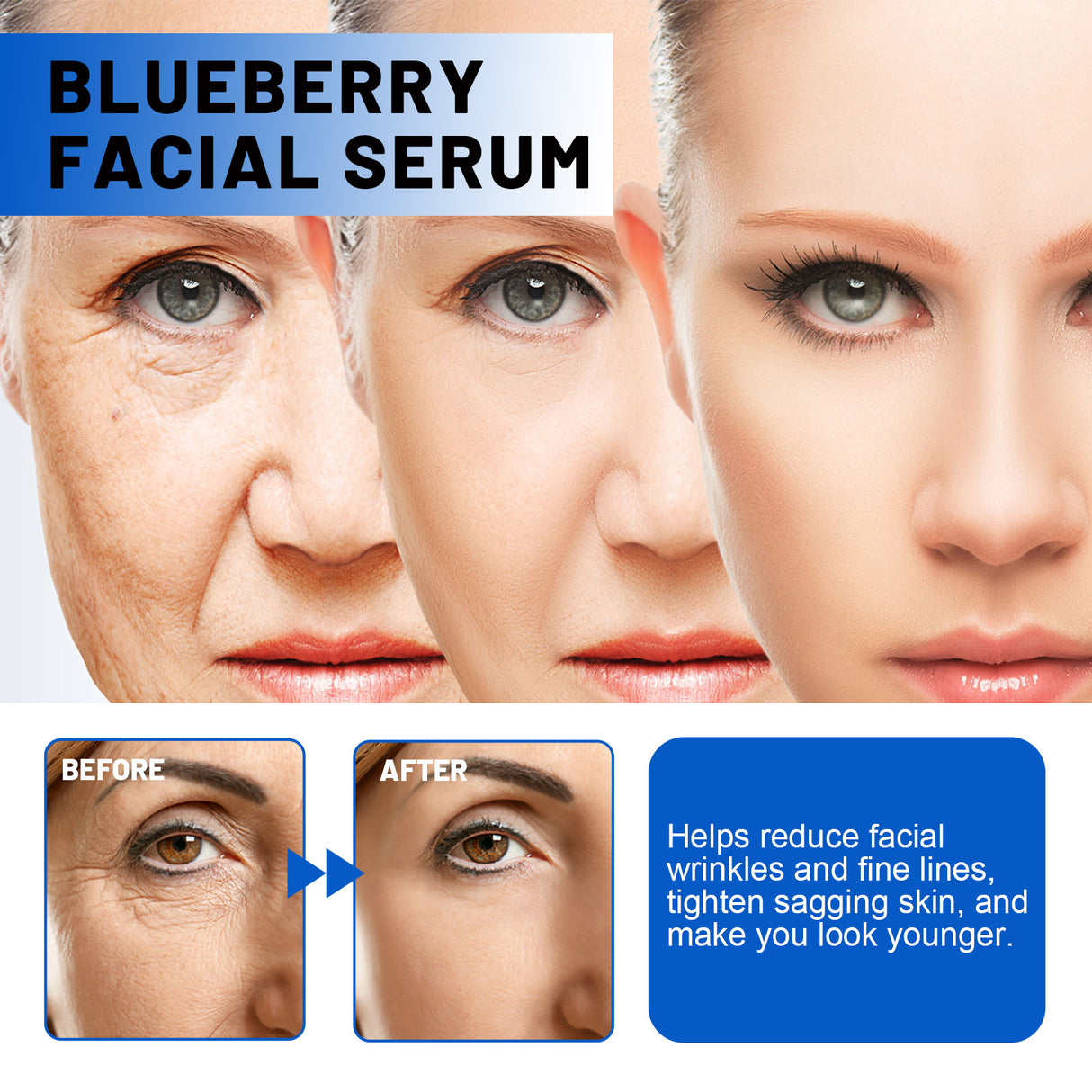 Blueberry Facial, Care Facial Skin Deep Cleansing Anti-Wrinkle Skin Care Essence Beauty Brightening Cream - V.I.P Digital Presence