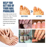 Nail Care Spray Gently Cleans Foot Nails Moisturizing And Brightening Nail Care Spray - V.I.P Digital Presence