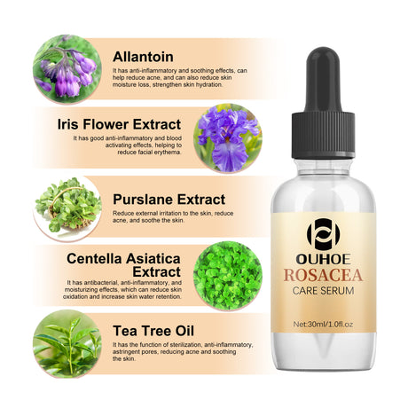 Erythematous Repair Essence, Repair Skin Lighten Facial Erythematous Moisturizing Essential Oil - V.I.P Digital Presence