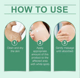 DermGlow Vitiligo Cream