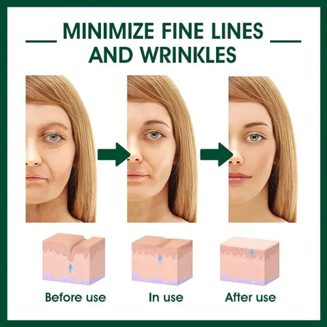 Facial Essence, Lifts And Tightens Facial Skin And Reduces Fine Lines And Wrinkles - V.I.P Digital Presence