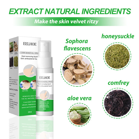 Skin Wart Removal Liquid, Skin Tag Cleaning Remove Hand And Foot Cocoon Corns Wart Removal Liquid - V.I.P Digital Presence